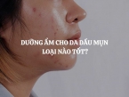 Dưỡng ẩm cho da dầu mụn loại nào tốt? Giải pháp dưỡng ẩm, kiềm dầu, giảm mụn từ HERBARIO